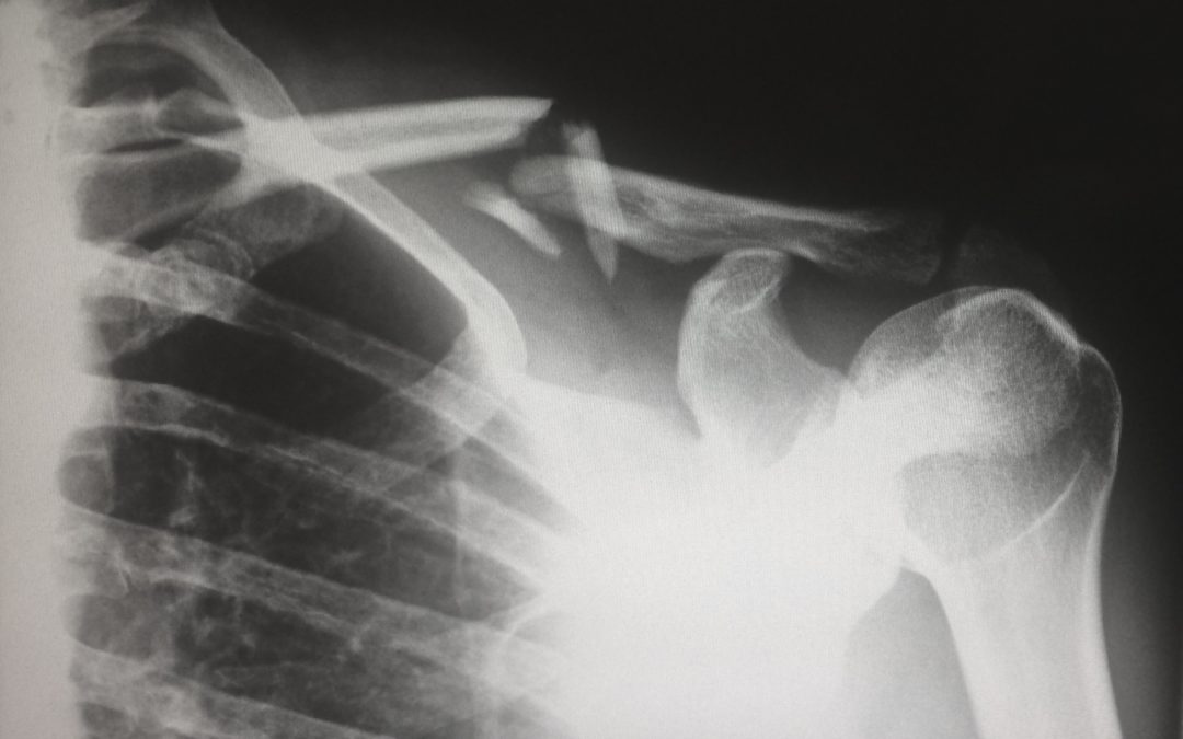WA Country Health Service defends claim of medical negligence