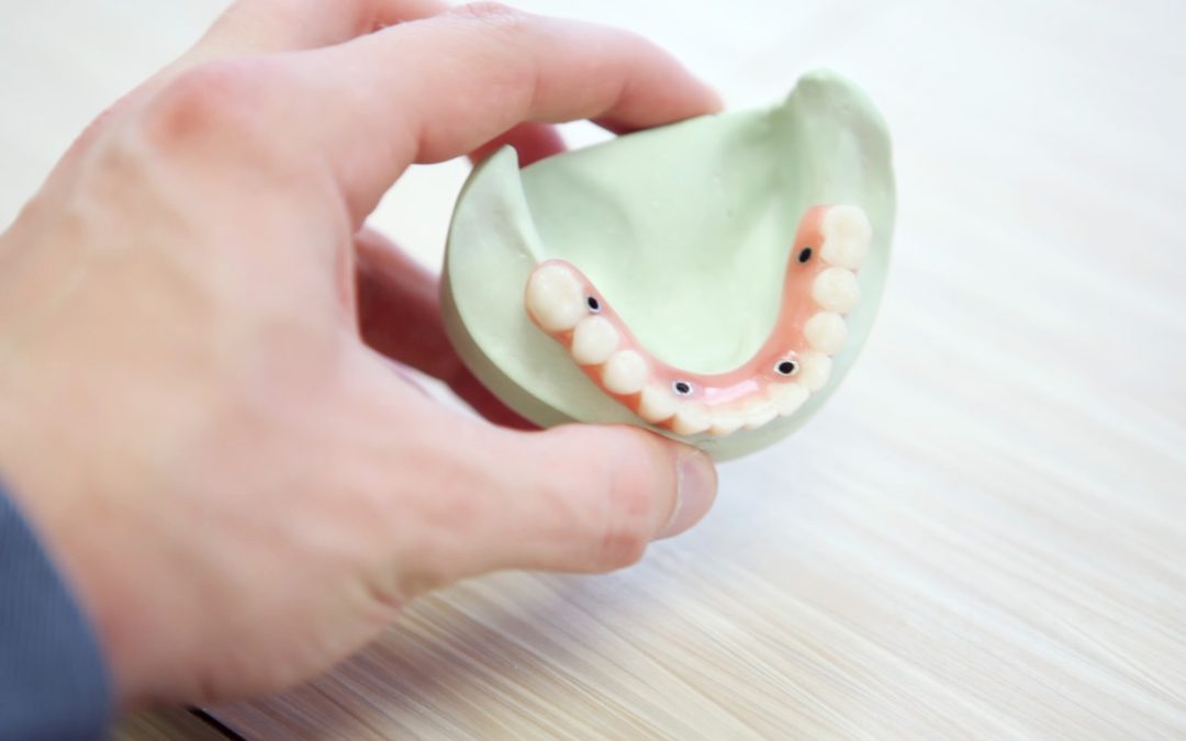 Case summary | Self-represented plaintiff awarded damages for failed dental implant procedure
