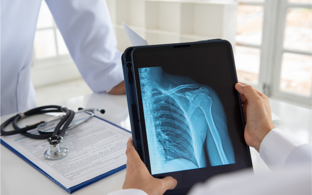 Case Summary| Inadequate reasons for decision leads to retrial in orthopaedic case